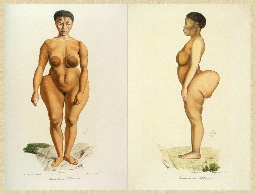 Front and side images of a nude honey-skinned woman with large fat deposits on her buttocks and hips. She has short dark hair and large brown areola.
